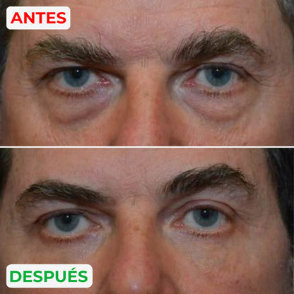 Reparador de bolsas y ojeras Esentia™