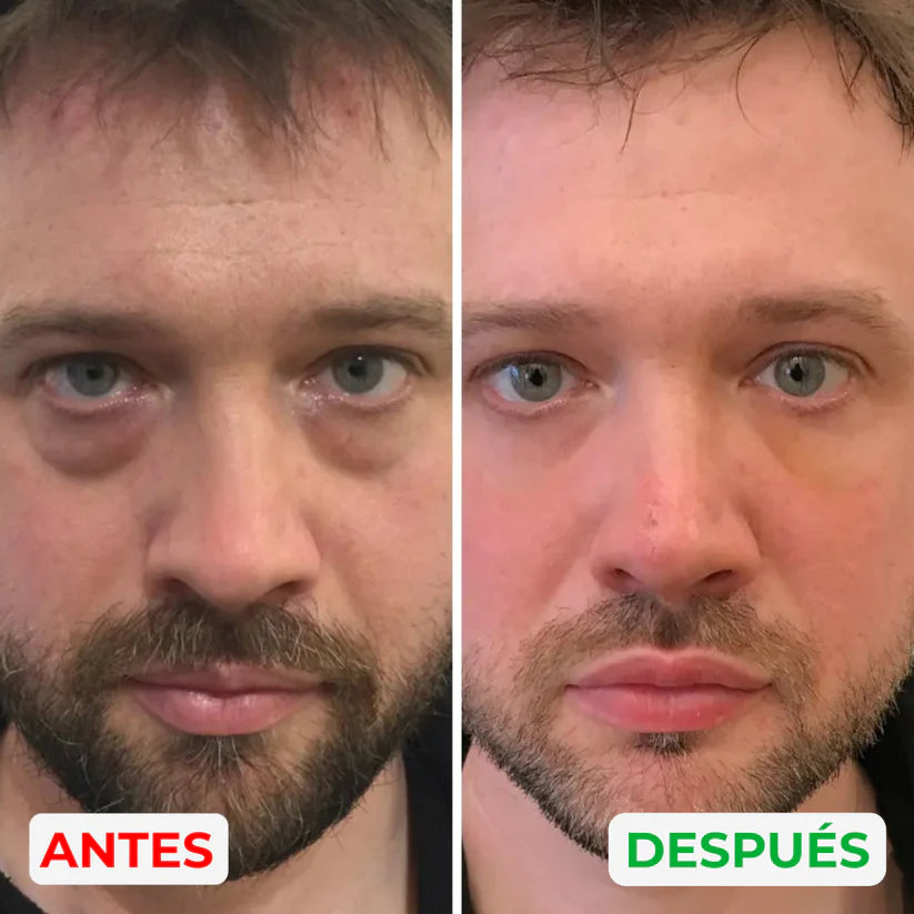 Reparador de bolsas y ojeras Esentia™