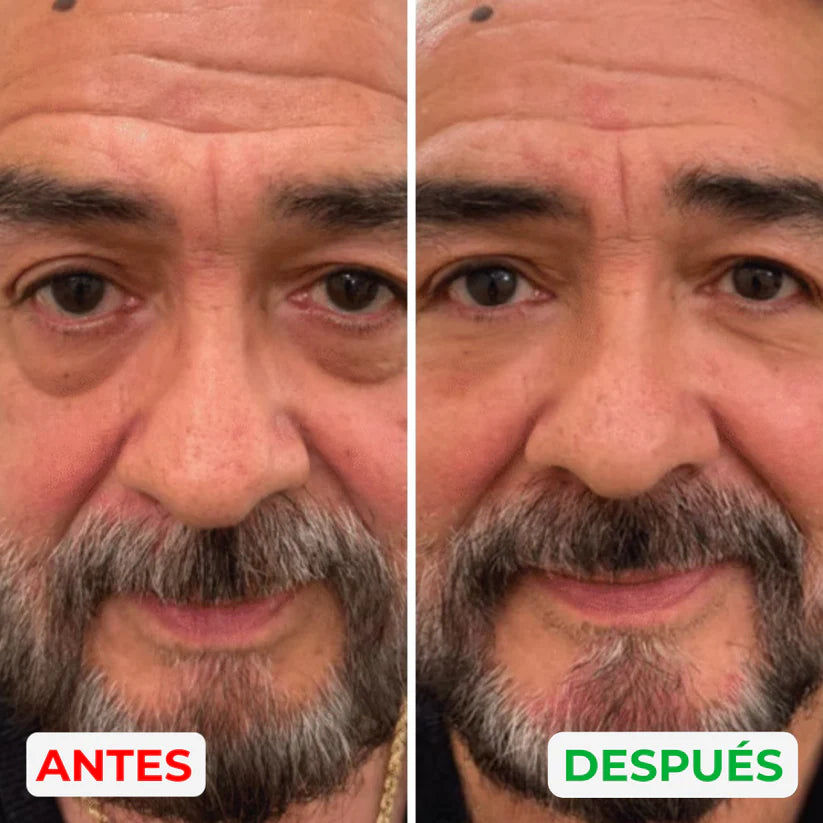 Reparador de bolsas y ojeras Esentia™
