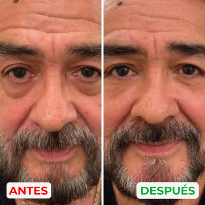 Reparador de bolsas y ojeras Esentia™